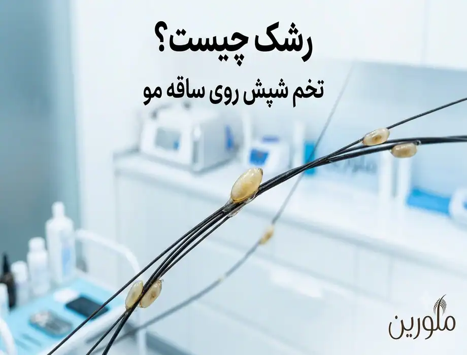 رشک یا تخم شپش روی ساقه مو