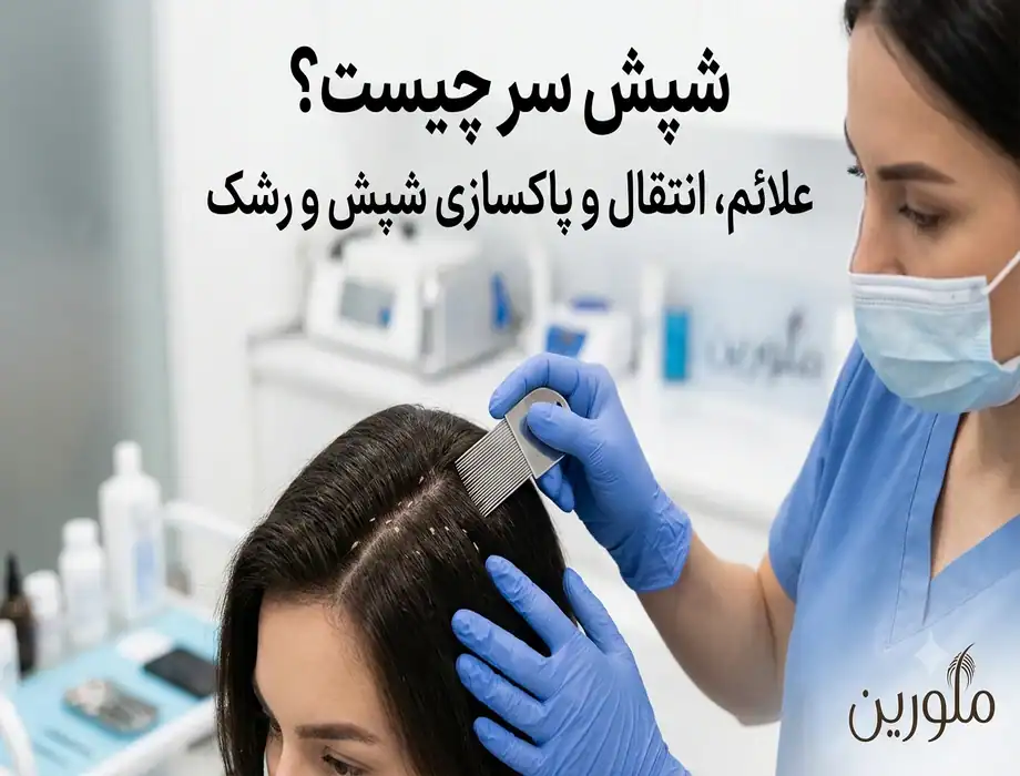 شپش سر چیست و چگونه تشخیص داده می‌شود